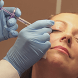 Dermal Fillers